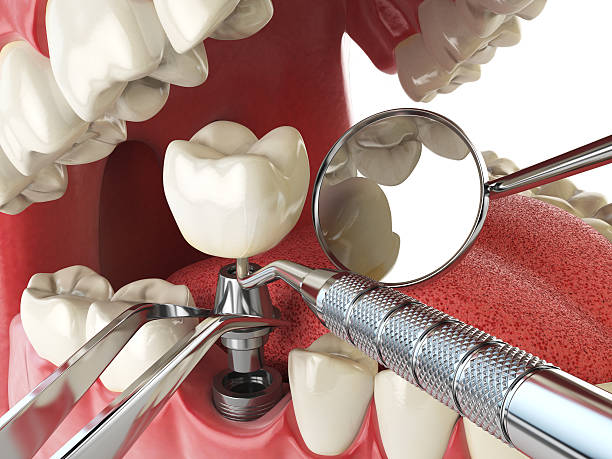 Best Emergency Cosmetic Dentistry (e.g., broken veneers) in Carolina Beach, NC