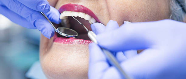Best Emergency Wisdom Tooth Extraction in Carolina Beach, NC